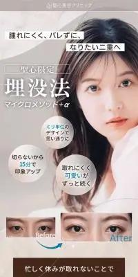 埋没法マイクロメソッド＋αのLPデザイン（エステ・脱毛・増毛・整形／ブラウン系／キレイ系）スマホ版