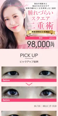 埋没法で腫れづらいスクエア二重術のLPデザイン（美容サービス／ピンク系／信頼・安心系）スマホ版