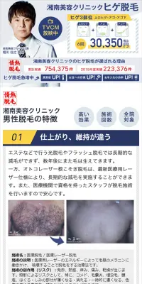 ヒゲ脱毛のLPデザイン（美容サービス／ブルー系／信頼・安心系）スマホ版