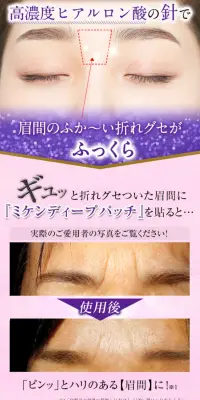 ミケンディープパッチのLPデザイン（美容・スキンケア・香水／パープル系／キレイ系）スマホ版