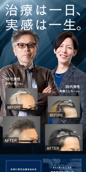 AGA治療のLPデザイン（美容サービス／ブラック系／信頼・安心系）スマホ版